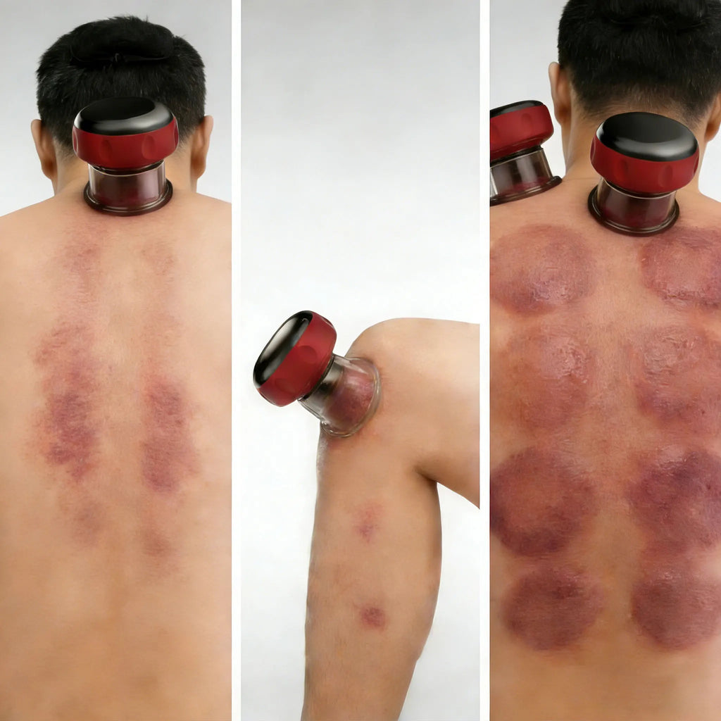 7-In-1 Smart Cupping Therapy Massager with Red Light Scraping Therapy