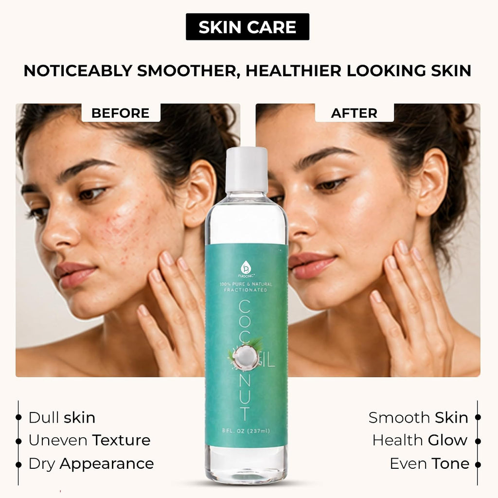 Pure Unscented Fractionated Coconut Oil - 8 Oz Multipurpose Oil for Skin, Hair, Body Massage & Makeup Removal - Carrier Oil for Essential Oils and Aromatherapy